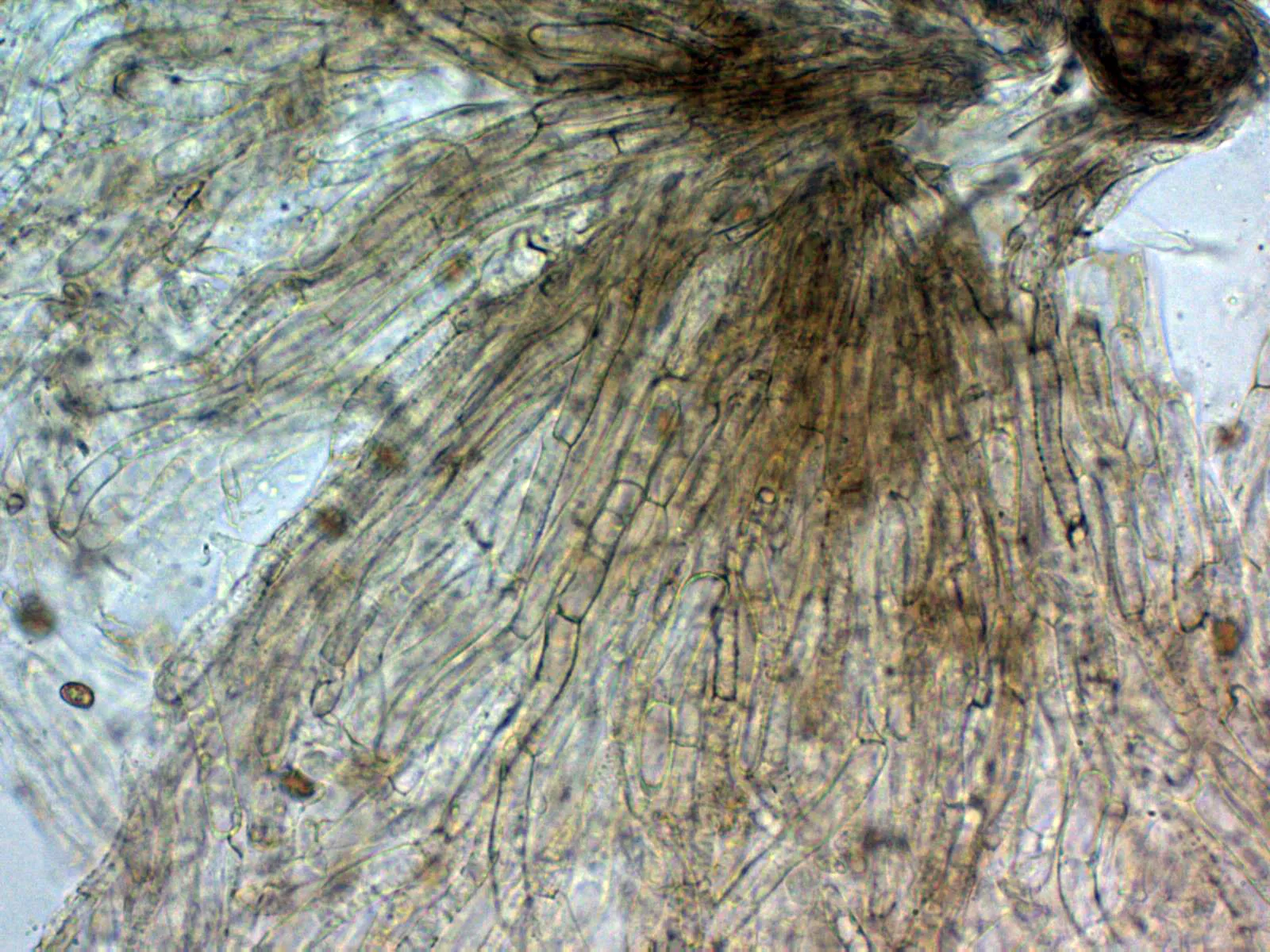 10 - Suprapellis agua x 400 2